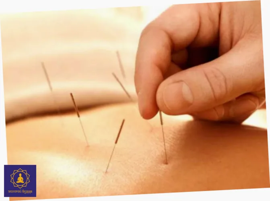 Акупунктура и рефлексотерапия: особенности методов