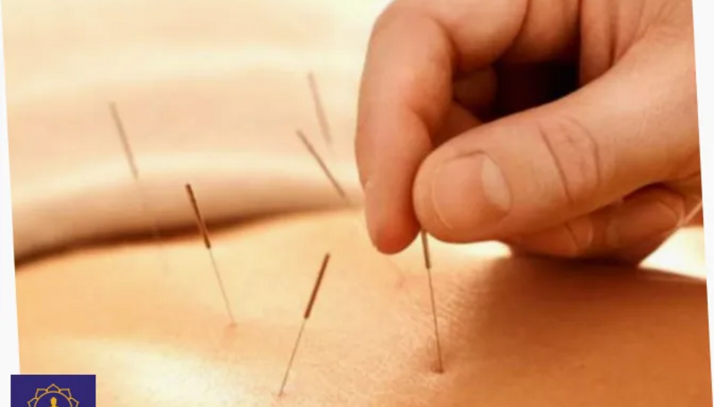 Акупунктура и рефлексотерапия: особенности методов