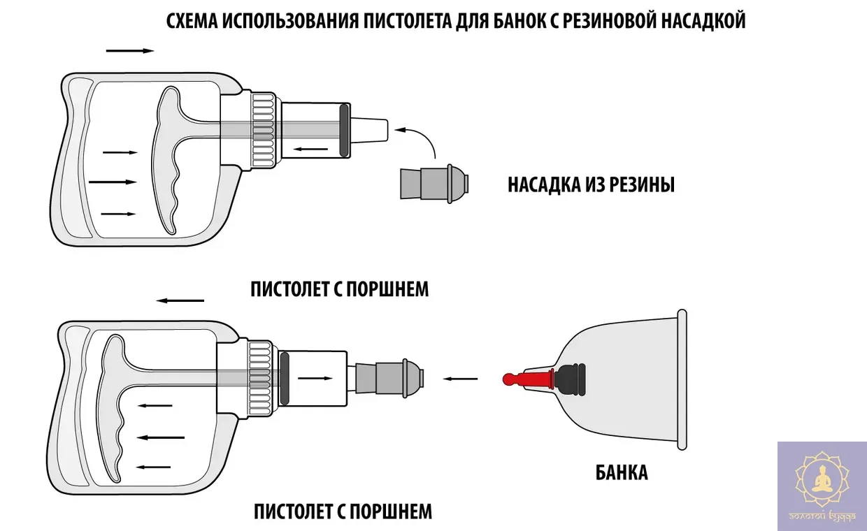 Вакуумний насос для масажних банок Kangzhu.